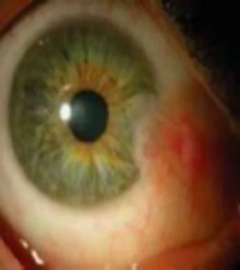 Eye Doctor near Bayside