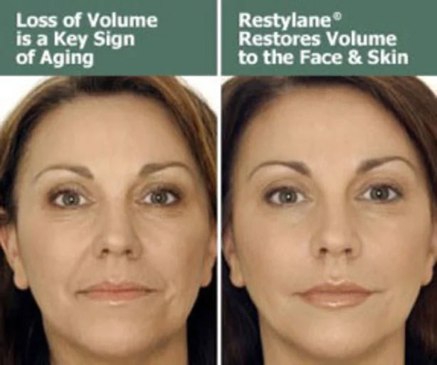 Bayside Botox Doctor