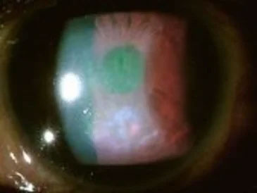 Ophthalmology Office near Bayside