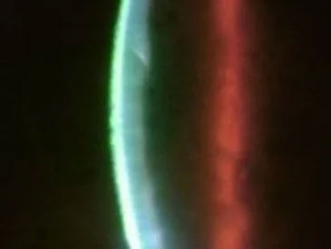 Ophthalmologist 11361