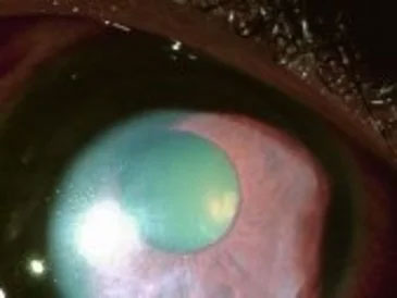 Ophthalmologist 11361