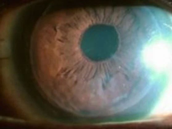 Ophthalmology Office near Bayside