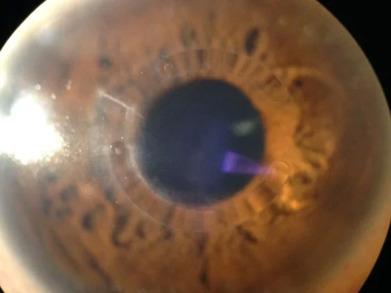 Eye Doctor near Bayside