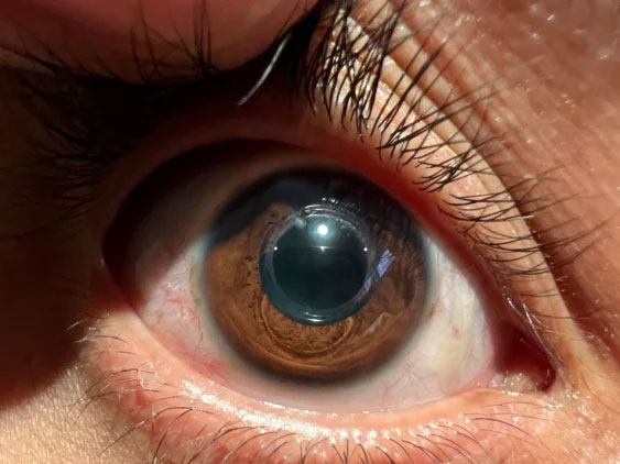 Ophthalmologist 11361